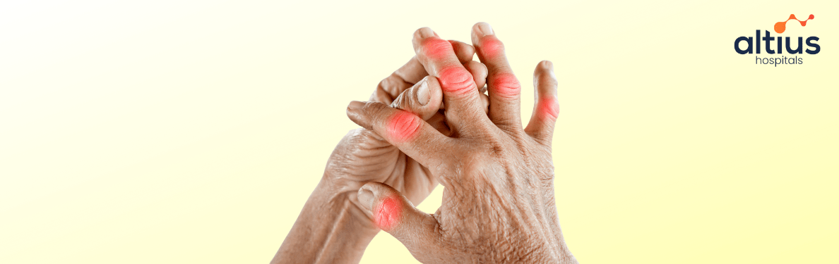 Signs Of Arthritis