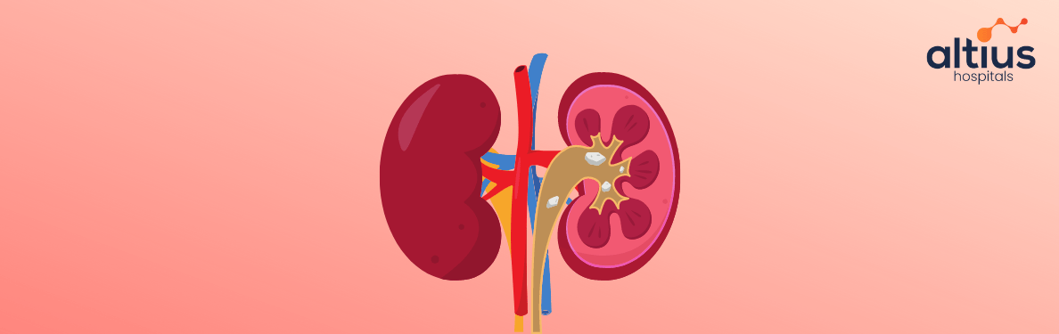 Kidney Stones Causes