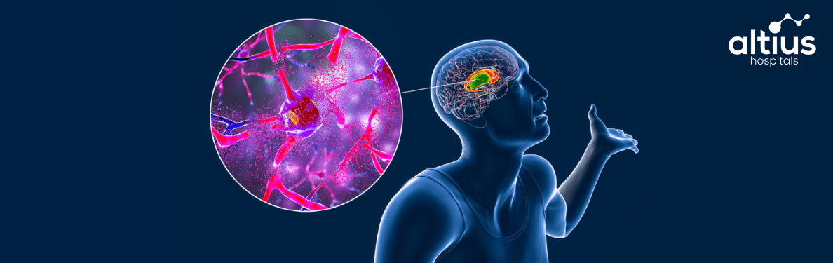 the Immune System in Neurodegenerative Diseases