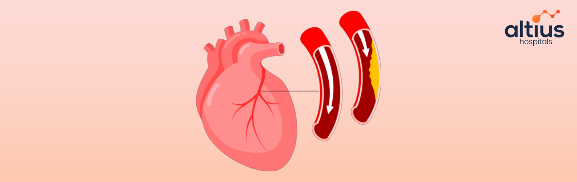 the Diagnosis of Coronary Artery Disease